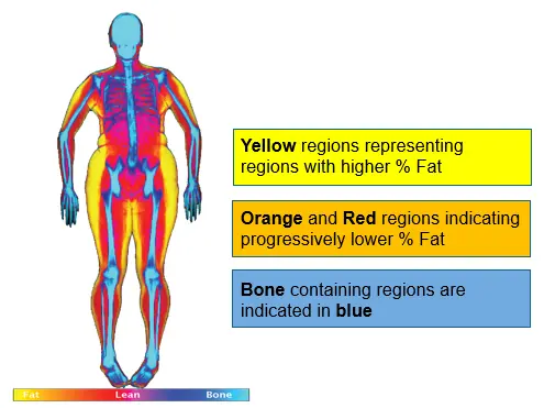 The Dexa Scan That Changed How I See My Body